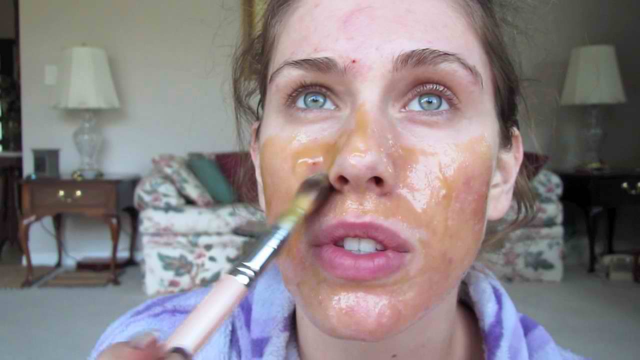 Can honey remove pimples?